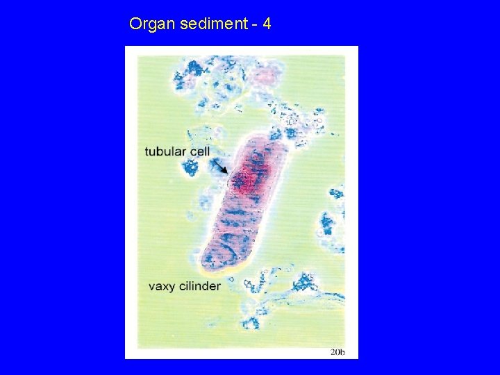 Organ sediment - 4 