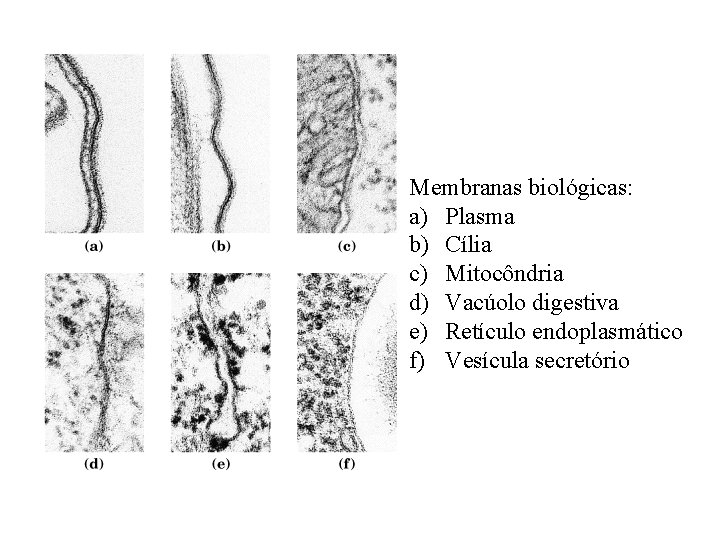 Membranas biológicas: a) Plasma b) Cília c) Mitocôndria d) Vacúolo digestiva e) Retículo endoplasmático