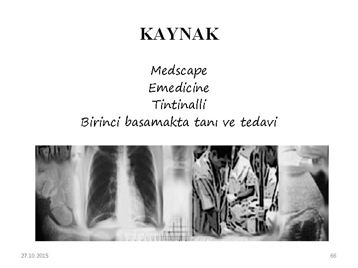 KAYNAK Medscape Emedicine Tintinalli Birinci basamakta tanı ve tedavi 27. 10. 2015 66 