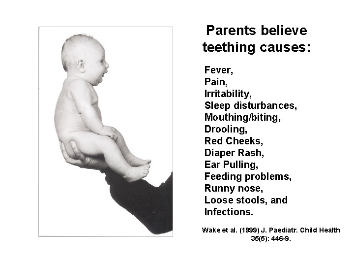 Parents believe teething causes: Fever, Pain, Irritability, Sleep disturbances, Mouthing/biting, Drooling, Red Cheeks, Diaper