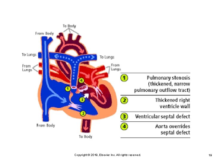Copyright © 2019, Elsevier Inc. All rights reserved. 19 Copyright © 2019, Elsevier Inc. All rights reserved. 19