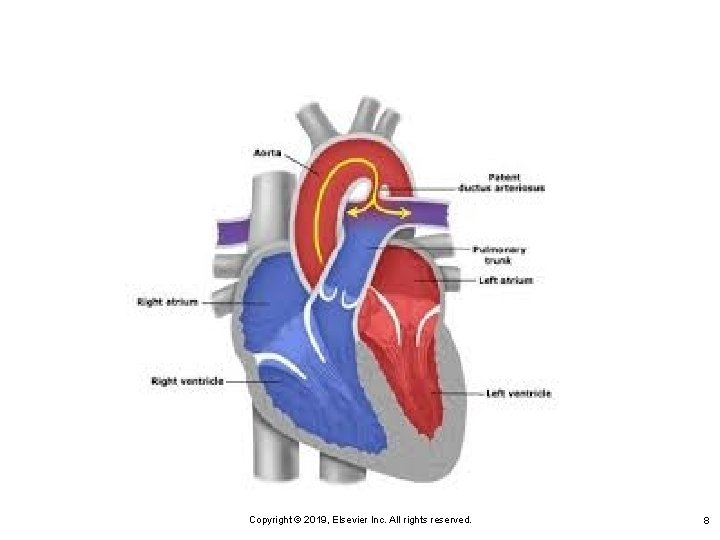 Copyright © 2019, Elsevier Inc. All rights reserved. 8 