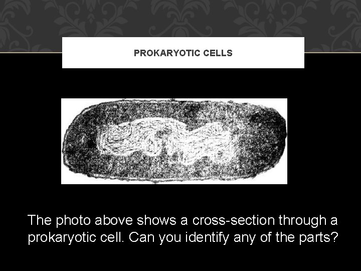 PROKARYOTIC CELLS The photo above shows a cross-section through a prokaryotic cell. Can you