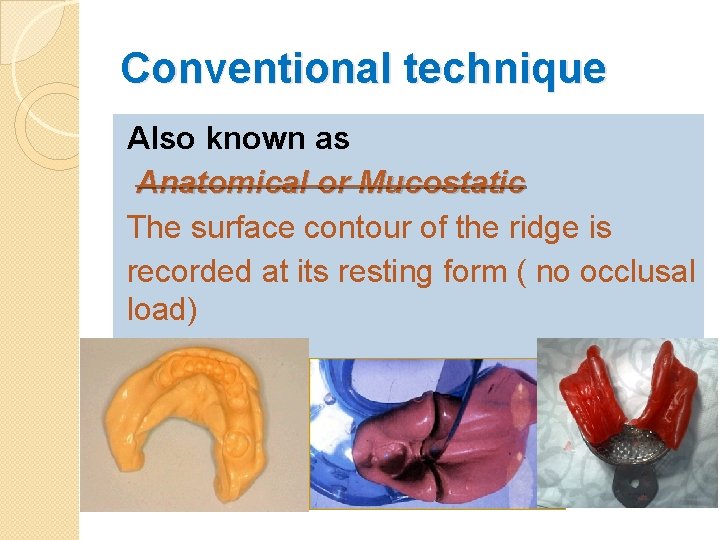 Conventional technique Also known as Anatomical or Mucostatic The surface contour of the ridge