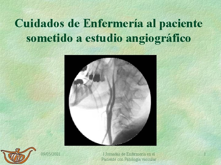 Cuidados de Enfermería al paciente sometido a estudio angiográfico 09/05/2001 I Jornadas de Enfermería