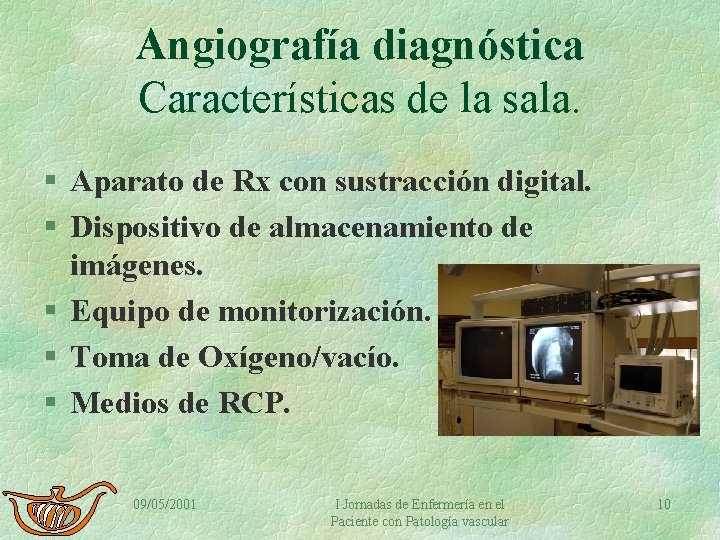 Angiografía diagnóstica Características de la sala. § Aparato de Rx con sustracción digital. §