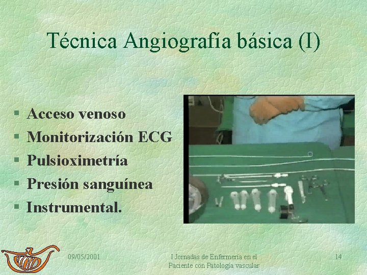 Técnica Angiografía básica (I) § § § Acceso venoso Monitorización ECG Pulsioximetría Presión sanguínea