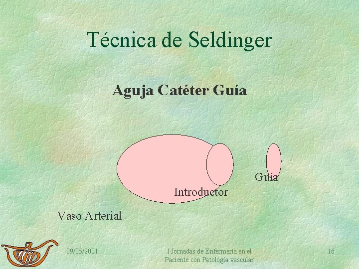 Técnica de Seldinger Aguja Catéter Guía Introductor Vaso Arterial 09/05/2001 I Jornadas de Enfermería