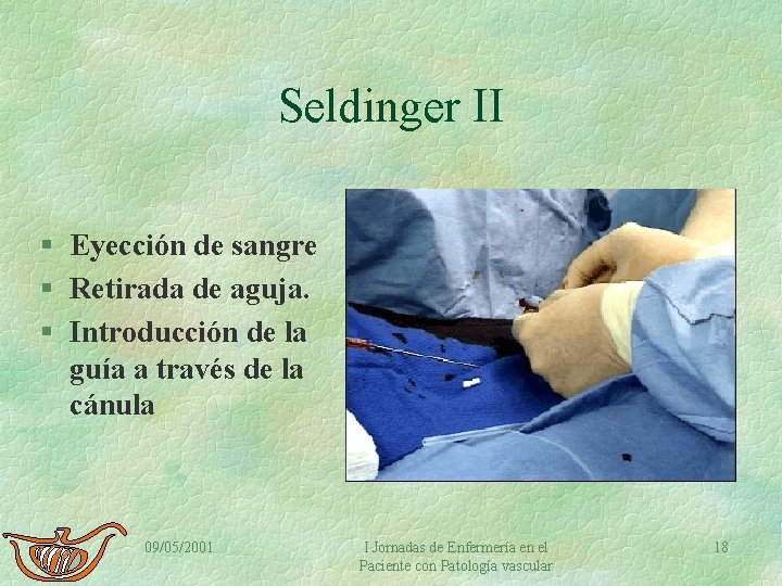 Seldinger II § Eyección de sangre § Retirada de aguja. § Introducción de la