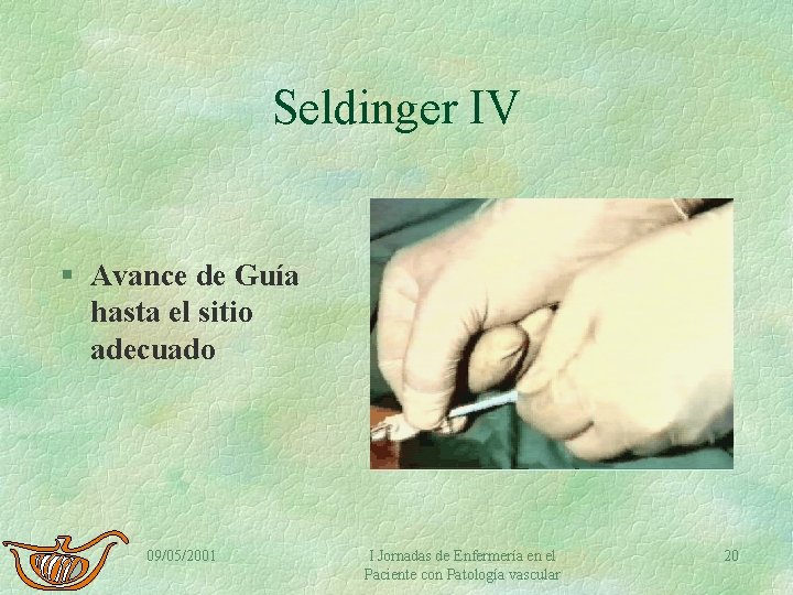 Seldinger IV § Avance de Guía hasta el sitio adecuado 09/05/2001 I Jornadas de