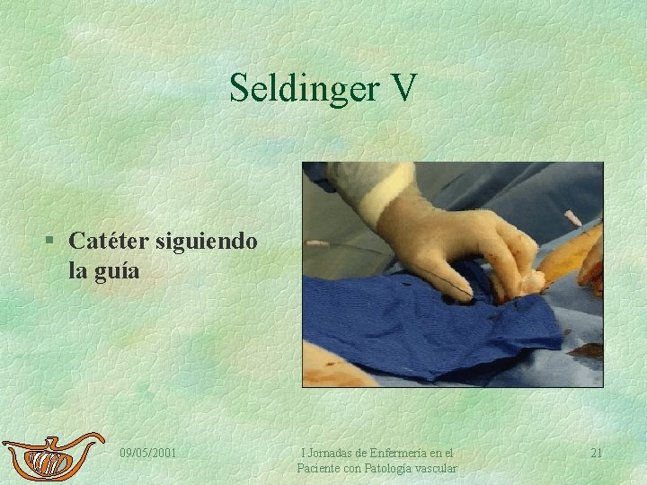 Seldinger V § Catéter siguiendo la guía 09/05/2001 I Jornadas de Enfermería en el
