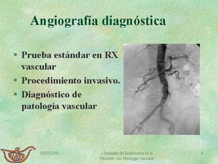 Angiografía diagnóstica § Prueba estándar en RX vascular § Procedimiento invasivo. § Diagnóstico de