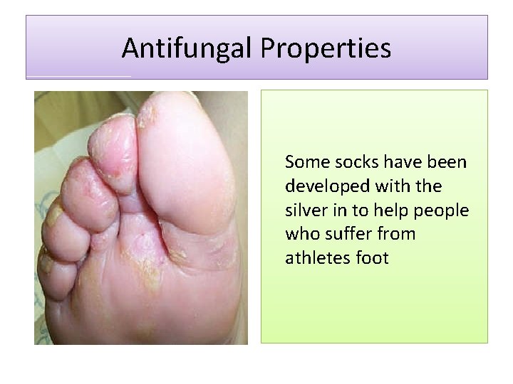 Antifungal Properties Some socks have been developed with the silver in to help people Antifungal Properties Some socks have been developed with the silver in to help people