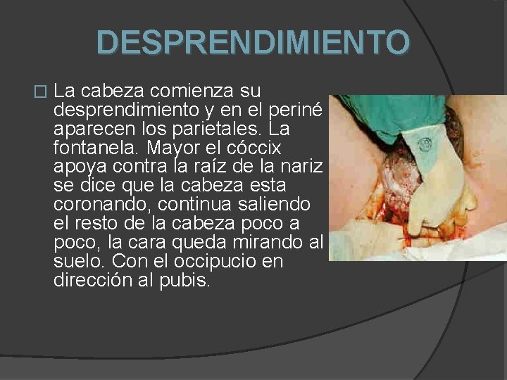 DESPRENDIMIENTO � La cabeza comienza su desprendimiento y en el periné aparecen los parietales.