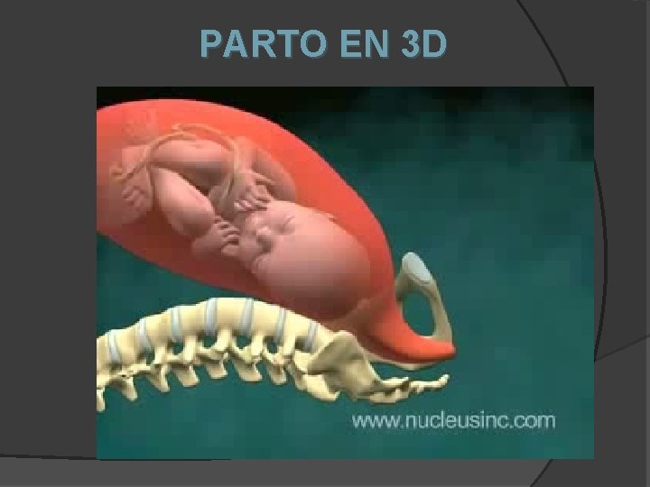 PARTO EN 3 D 