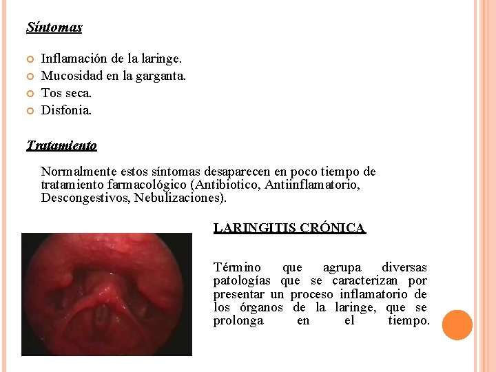 Síntomas Inflamación de la laringe. Mucosidad en la garganta. Tos seca. Disfonia. Tratamiento Normalmente