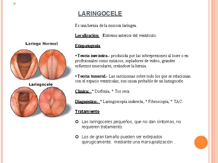  LARINGOCELE Es una hernia de la mucosa laríngea. Localización: Extremo anterior del ventrículo.