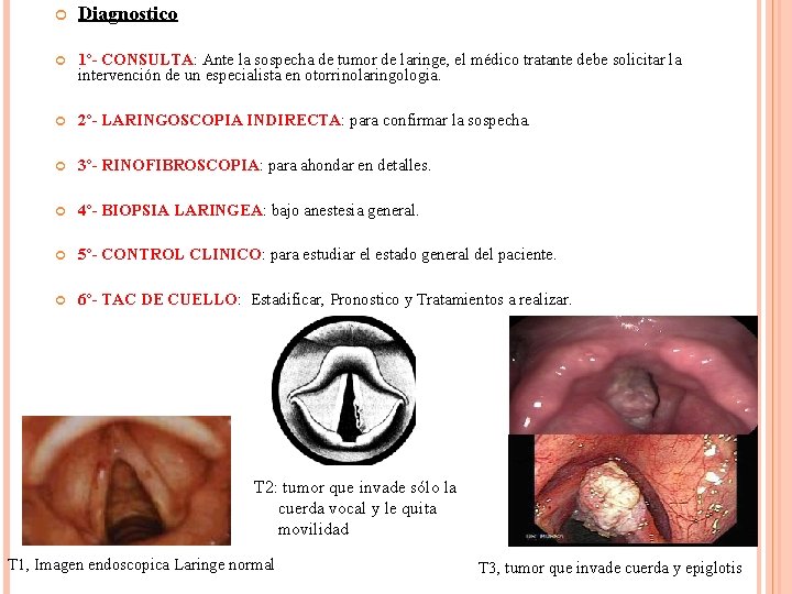  Diagnostico 1º- CONSULTA: Ante la sospecha de tumor de laringe, el médico tratante