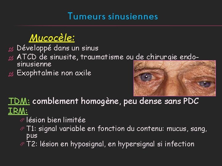 Tumeurs sinusiennes Mucocèle: Développé dans un sinus ATCD de sinusite, traumatisme ou de chirurgie