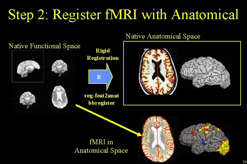 Step 2: Register f. MRI with Anatomical Native Anatomical Space Native Functional Space Rigid