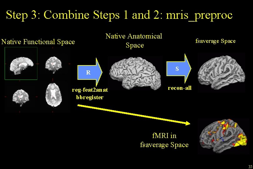 Step 3: Combine Steps 1 and 2: mris_preproc Native Anatomical Space Native Functional Space