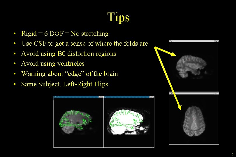 Tips • • • Rigid = 6 DOF = No stretching Use CSF to