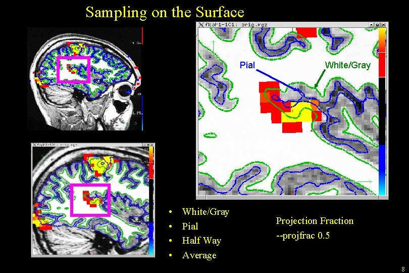 Sampling on the Surface Pial • • White/Gray Pial Half Way Average White/Gray Projection