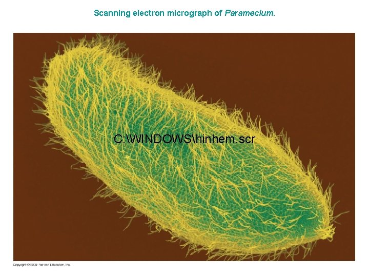 Scanning electron micrograph of Paramecium. C: WINDOWShinhem. scr Scanning electron micrograph of Paramecium. C: WINDOWShinhem. scr