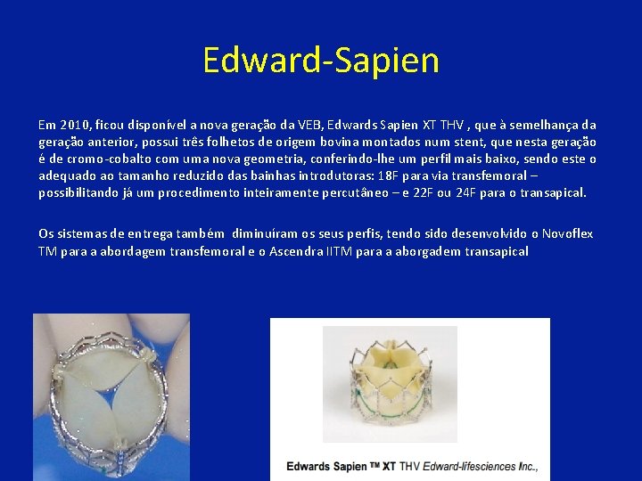 Edward-Sapien Em 2010, ficou disponível a nova geração da VEB, Edwards Sapien XT THV