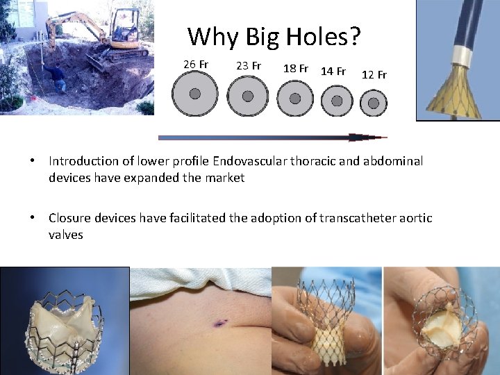 Why Big Holes? 26 Fr 23 Fr 18 Fr 14 Fr 12 Fr •