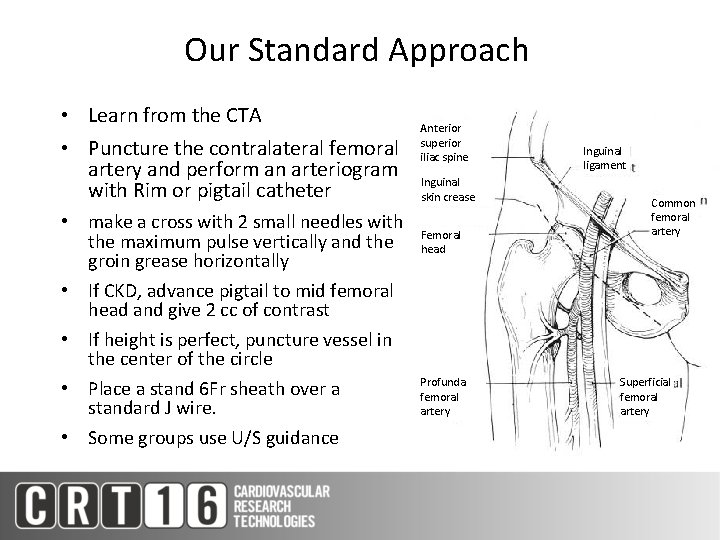 Our Standard Approach • Learn from the CTA • Puncture the contralateral femoral artery