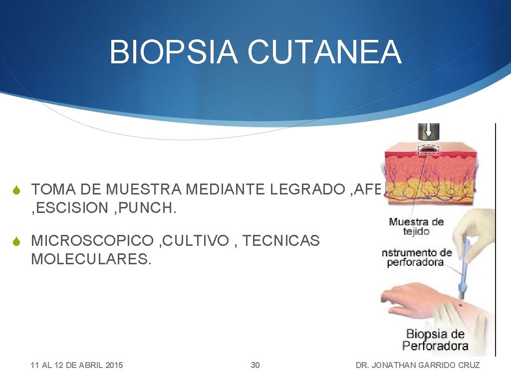 BIOPSIA CUTANEA S TOMA DE MUESTRA MEDIANTE LEGRADO , AFEITADO , ESCISION , PUNCH.