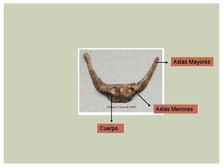 Astas Mayores Astas Menores Cuerpo 