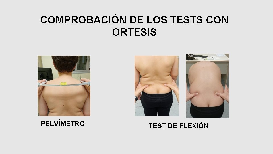 COMPROBACIÓN DE LOS TESTS CON ORTESIS PELVÍMETRO TEST DE FLEXIÓN 