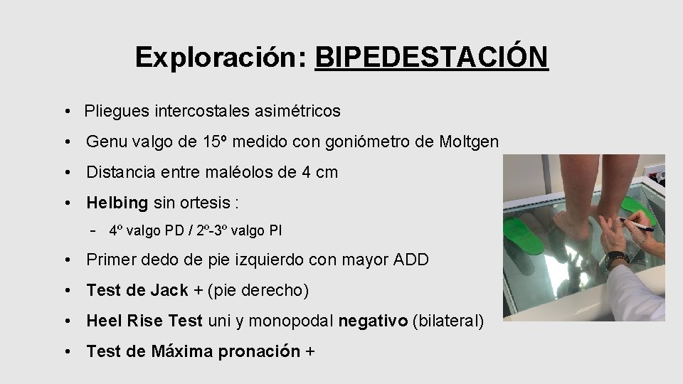 Exploración: BIPEDESTACIÓN • Pliegues intercostales asimétricos • Genu valgo de 15º medido con goniómetro