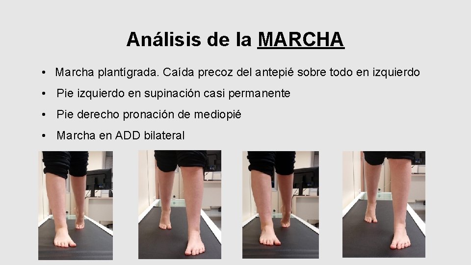 Análisis de la MARCHA • Marcha plantígrada. Caída precoz del antepié sobre todo en