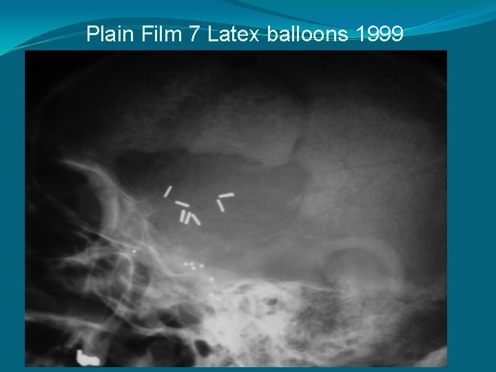 Plain Film 7 Latex balloons 1999 