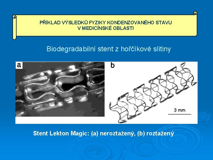 PŘÍKLAD VÝSLEDKŮ FYZIKY KONDENZOVANÉHO STAVU V MEDICÍNSKÉ OBLASTI Biodegradabilní stent z hořčíkové slitiny Stent