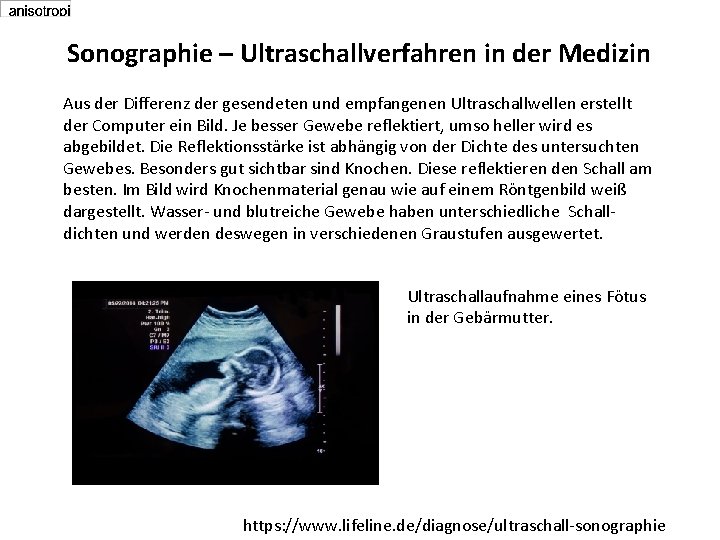 Sonographie – Ultraschallverfahren in der Medizin Aus der Differenz der gesendeten und empfangenen Ultraschallwellen Sonographie – Ultraschallverfahren in der Medizin Aus der Differenz der gesendeten und empfangenen Ultraschallwellen