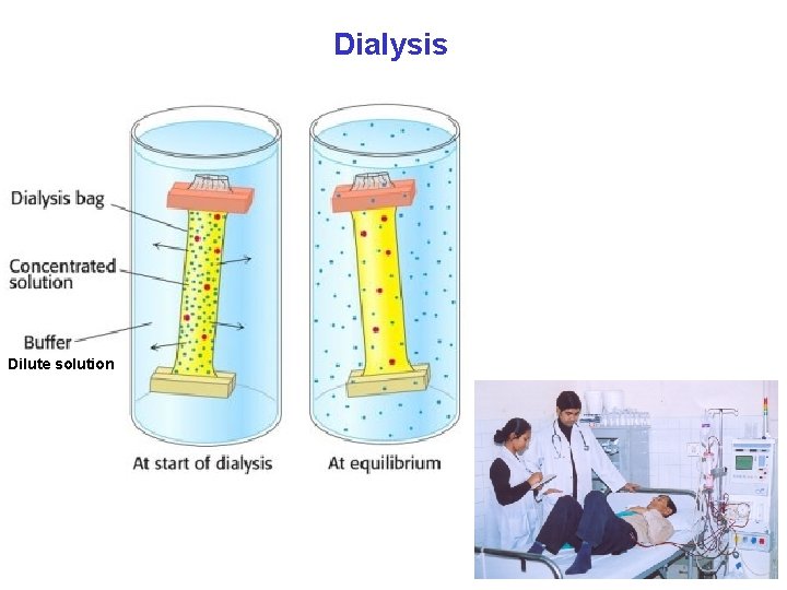 Dialysis Dilute solution 