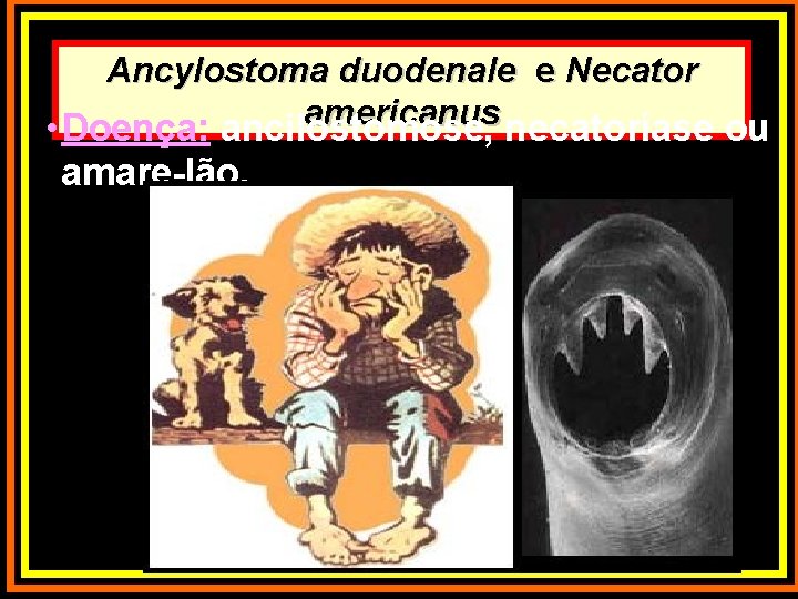 Ancylostoma duodenale e Necator americanus • Doença: ancilostomose, necatoríase ou amare-lão. 