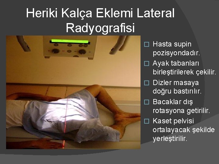 Heriki Kalça Eklemi Lateral Radyografisi � � � Hasta supin pozisyondadır. Ayak tabanları birleştirilerek