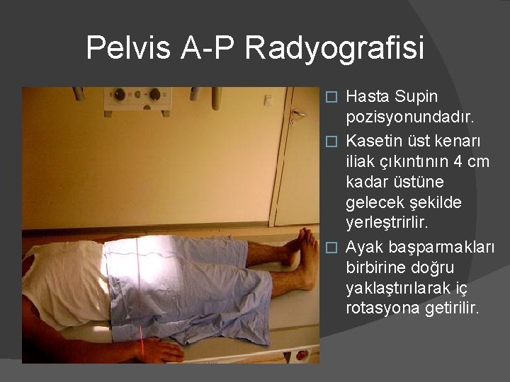 Pelvis A-P Radyografisi Hasta Supin pozisyonundadır. � Kasetin üst kenarı iliak çıkıntının 4 cm