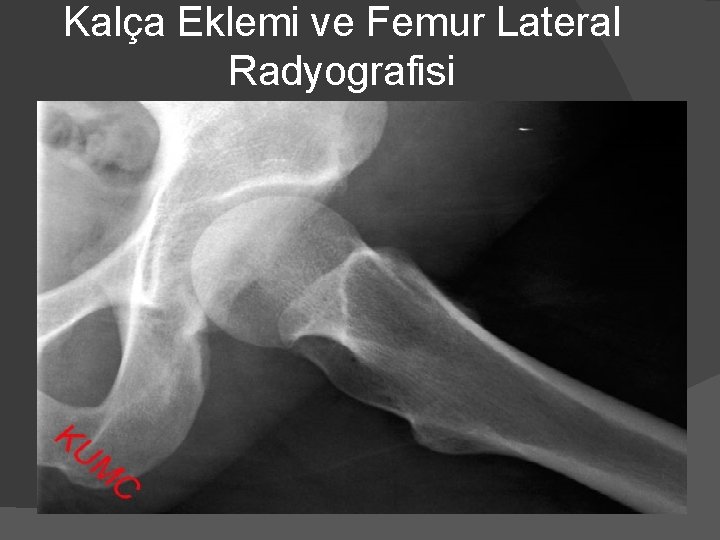 Kalça Eklemi ve Femur Lateral Radyografisi 