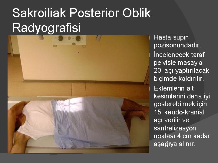 Sakroiliak Posterior Oblik Radyografisi Hasta supin pozisonundadır. � İncelenecek taraf pelvisle masayla 20’ açı