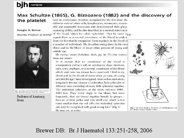 Professor of Anatomy, Bonn Brewer DB: Br J Haematol 133: 251 -258, 2006 