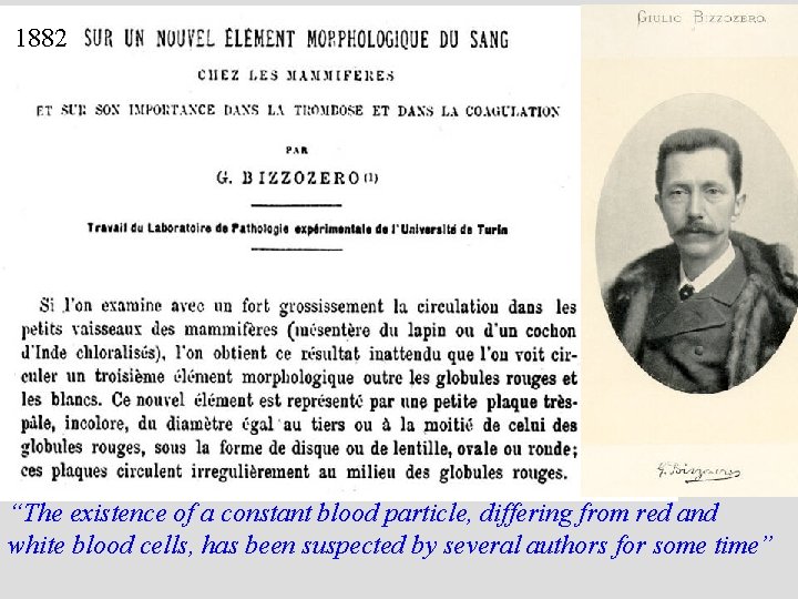 1882 “The existence of a constant blood particle, differing from red and white blood