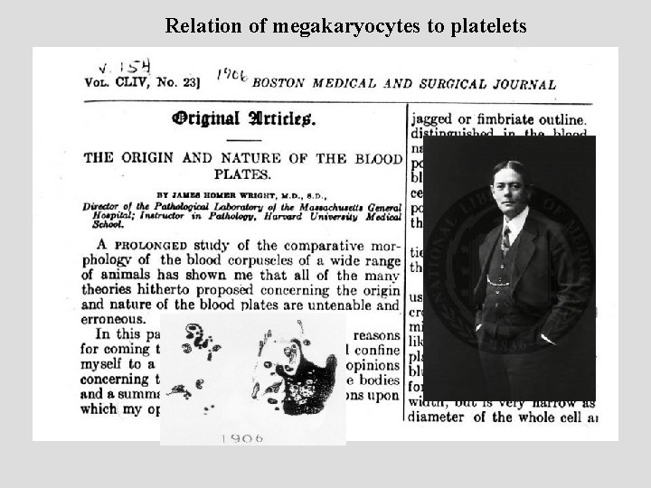 Relation of megakaryocytes to platelets 