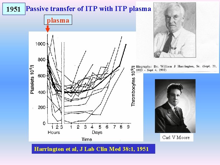 1951 Passive transfer of ITP with ITP plasma Carl V Moore Harrington et al,