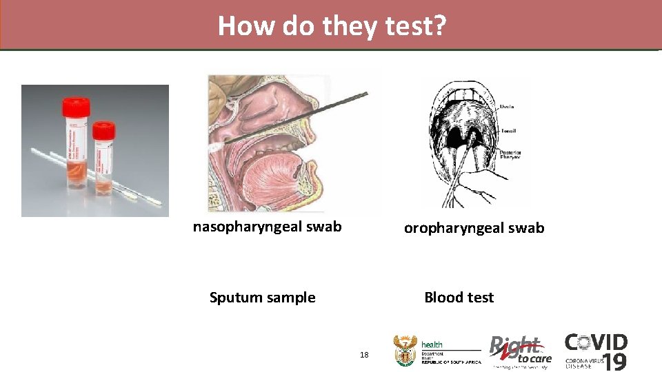 How do they test? nasopharyngeal swab oropharyngeal swab Sputum sample Blood test 18 